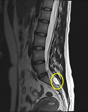 mri-22